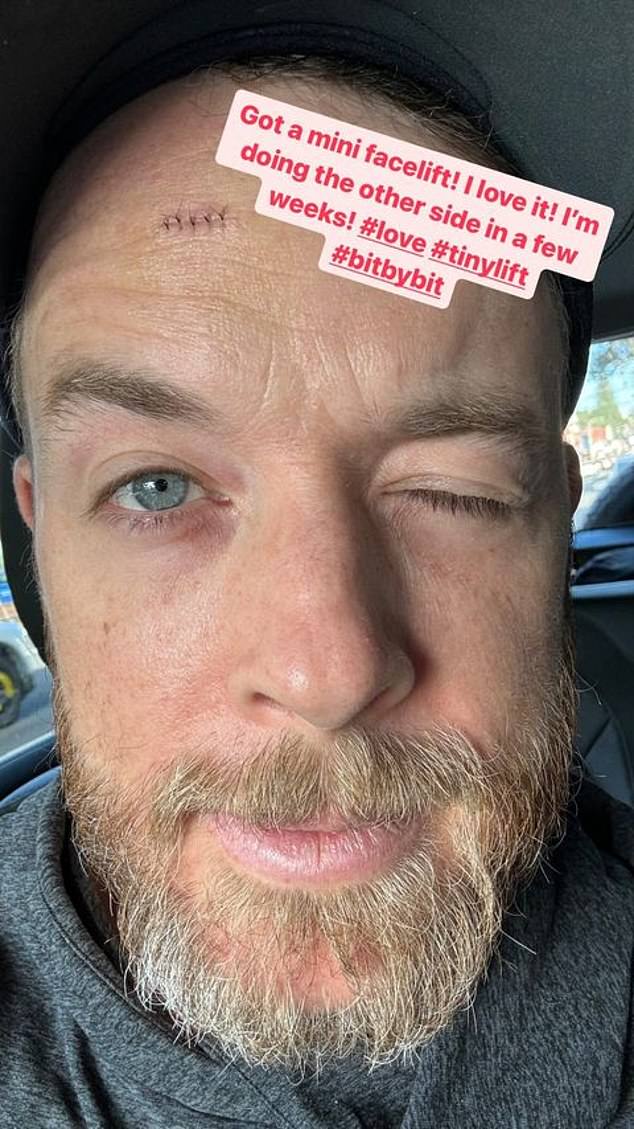 Comedian Hamish Blake reveals health scare as he undergoes emergency surgery