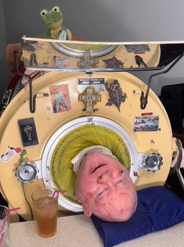 How iron lungs work: Life-saving contraption devised in the 1920s saved the lives of thousands of polio victims – and had to be repaired by mechanics