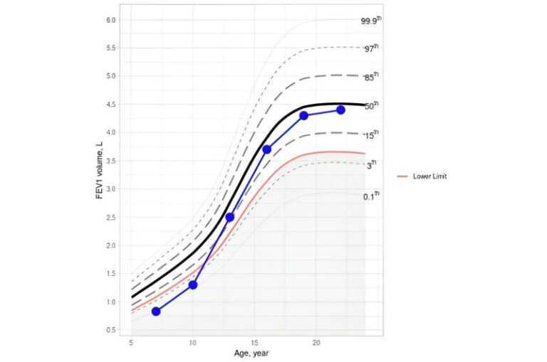 New digital tool enables monitoring of lung function over time