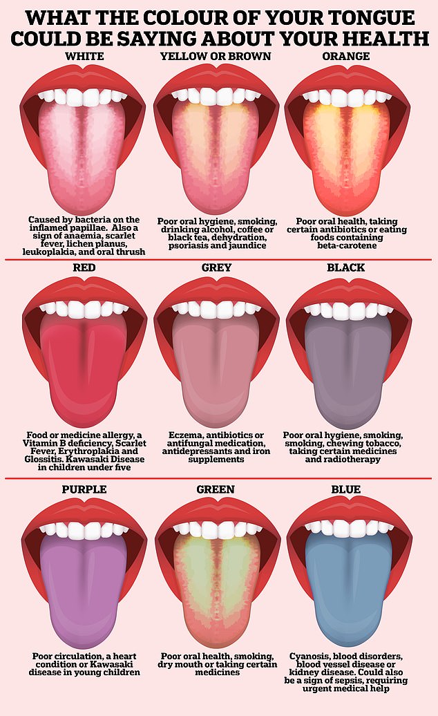 Open wide! What the COLOUR of your tongue could be saying about your health