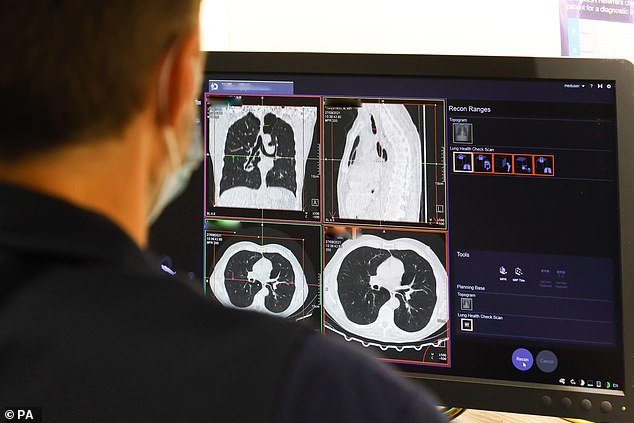 Scientists are making a ‘groundbreaking’ lung cancer vaccine that could prevent up to 90% of cases