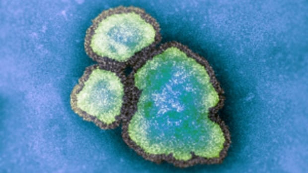 B.C. reports first measles case since 2019