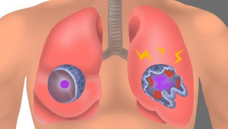 Uninfected vs Infected Interstitial Macrophage