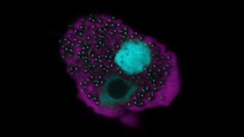 An Amoeba Cell Infected by Naegleriavirus