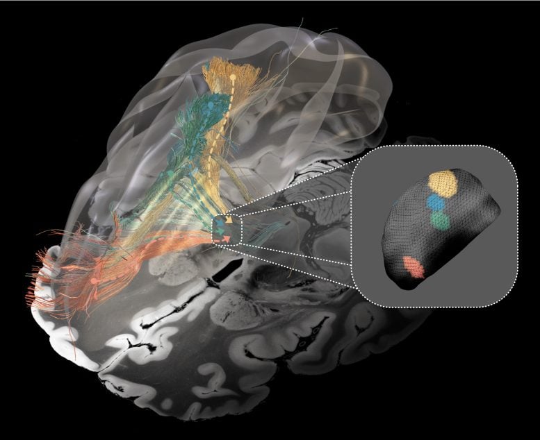 Affected Brain Circuits in Parkinson’s Disease, Dystonia, Tourette’s Syndrome, and Obsessive Compulsive Disorder