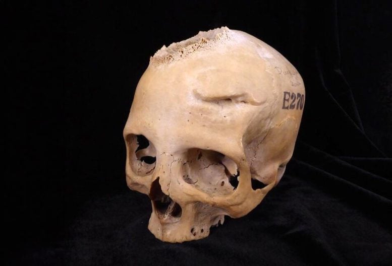 Skull E270