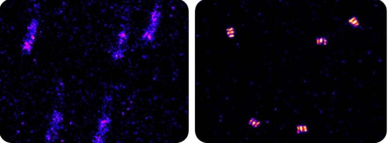 AIM algorithm enhances super-resolution microscope images in real time