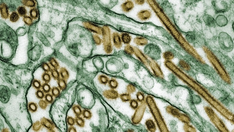 Colorized transmission electron micrograph of Avian influenza A H5N1 viruses (seen in gold) grown in MDCK cells (seen in green).