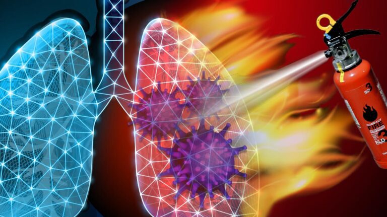 The Ferroptosis Link in COVID-19 Lung Destruction