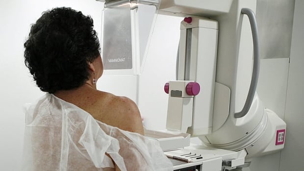 Breast screening at age 40 not routinely advised, Canadian task force says