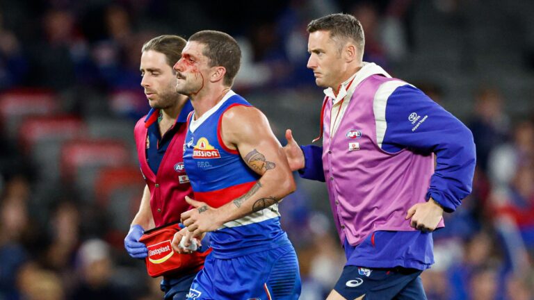 Tom Liberatore cleared of concussion symptoms, Luke Beveridge comments, medical retirement, Angus Brayshaw