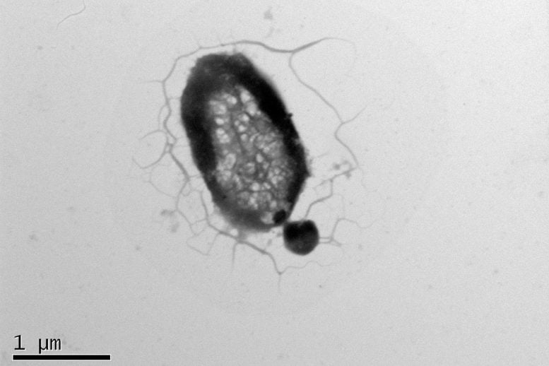 Parasitic Archaea Attached to Host