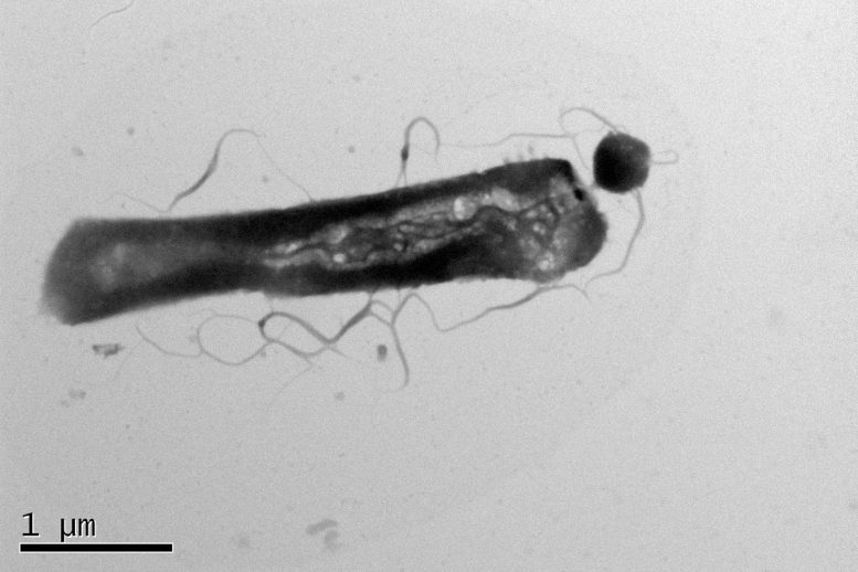 Parasitic Archaea Attached to Its Host