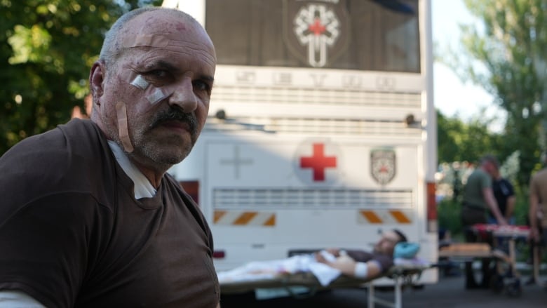 An older man with bandages on his face stands behind a white bus. 