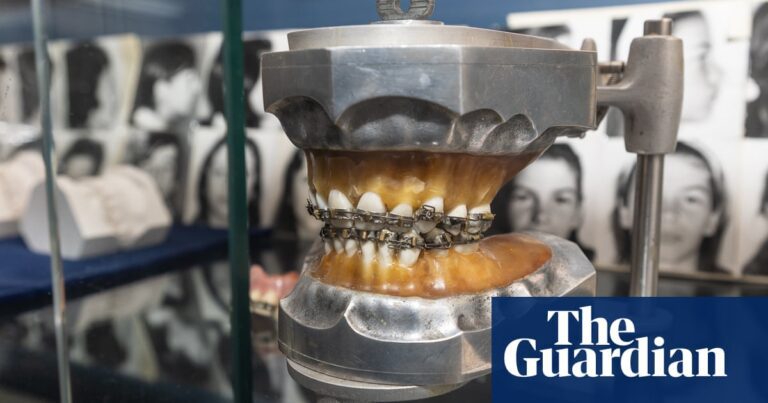 Oral history: how Tick Begg revolutionised braces and made 1920s Adelaide ‘the orthodontic centre of the world’ | Adelaide