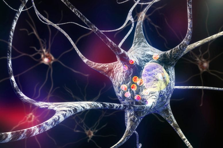 Parkinson’s Disease Nerve Cells