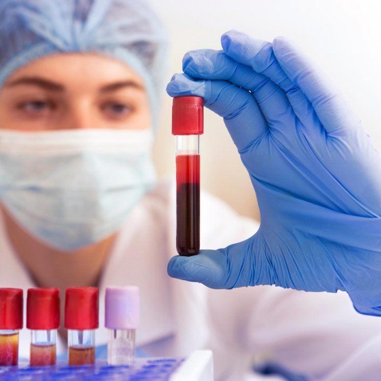 Medical Blood Test Tubes