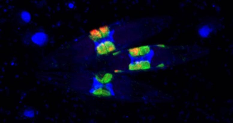 Diatoms With Their Fluorescently Labeled Symbionts