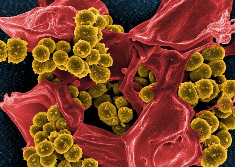 Staphylococcus aureaus