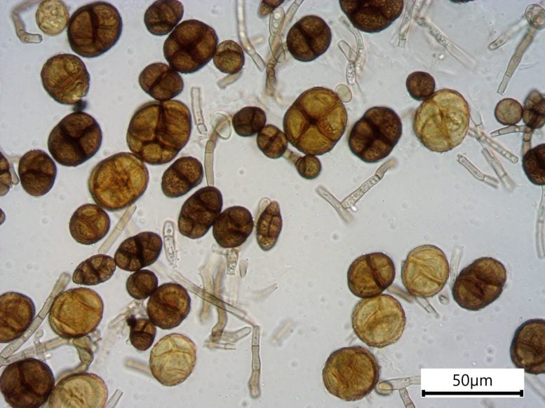 Conidia of Alternaria Fungus Culture