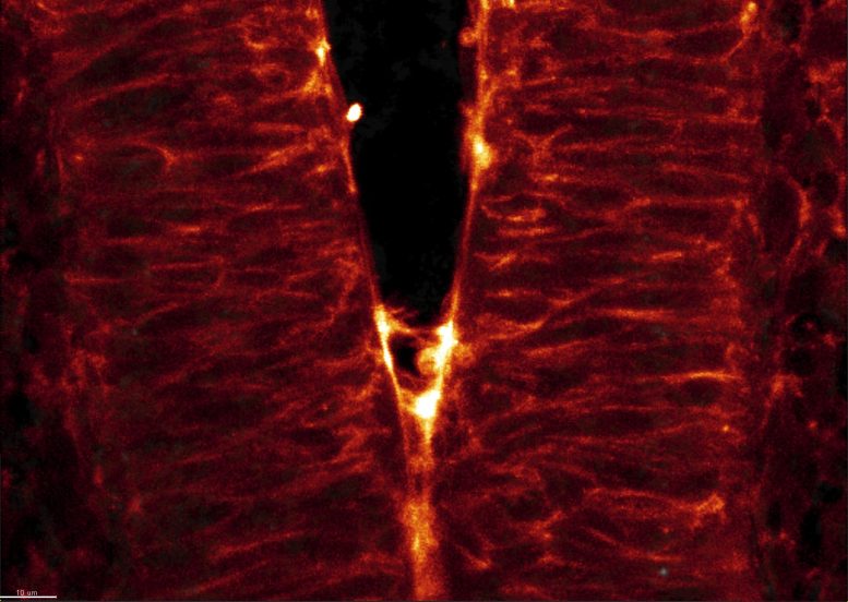 Bilateral Cell Protrusions