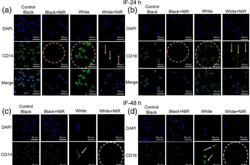 Innovative photobiomodulation technique illuminates a new frontier in neurodegenerative disease treatment