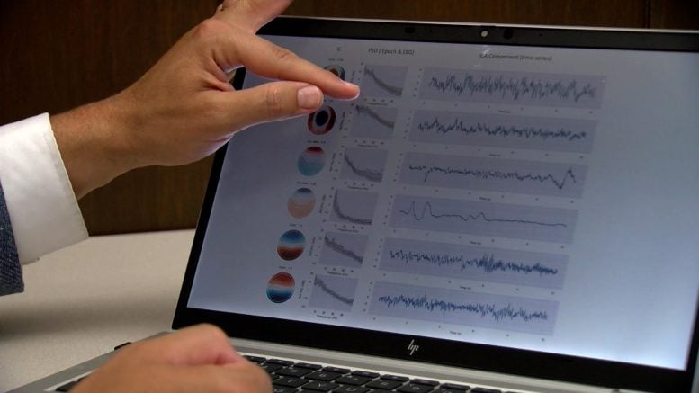 Electroencephalogram Results EEG Test