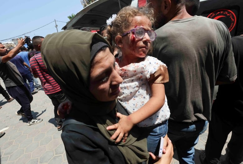 A woman carries a child with blood on her face.