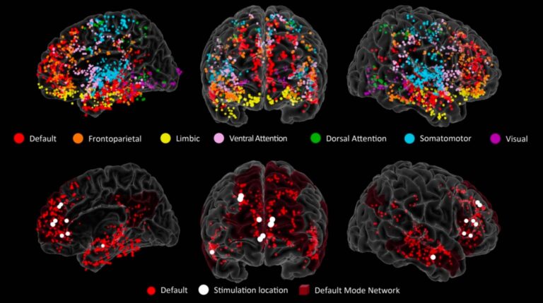 Neuroscientists Have Pinpointed the Origins of Creativity in the Brain