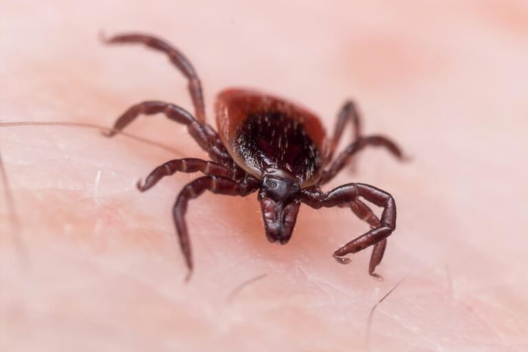 Could You Have Lyme Disease and Not Know It?