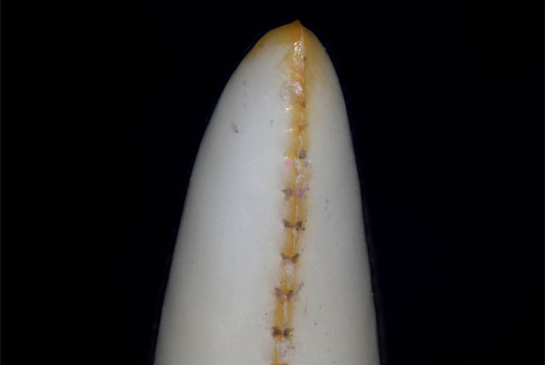 Closeup of a tooth showing a brownish-yellow line around the serrated edges, and at the pointed tip.