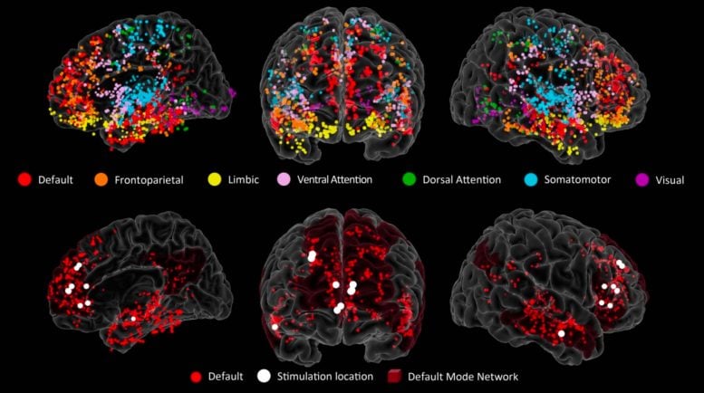 Brain Electrode Map