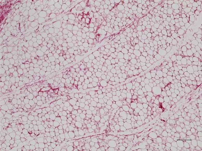 Ordinary White Fat Cells