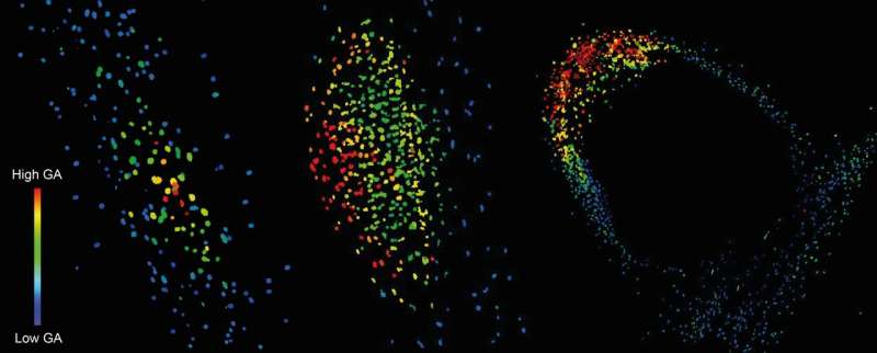 Next generation biosensor reveals gibberellin's critical role in legume nitrogen-fixation