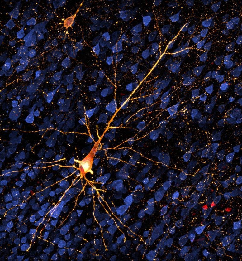 Dying Neuron Damaged by Tau Protein