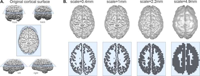 Study identifies universal blueprint for mammalian brain shape