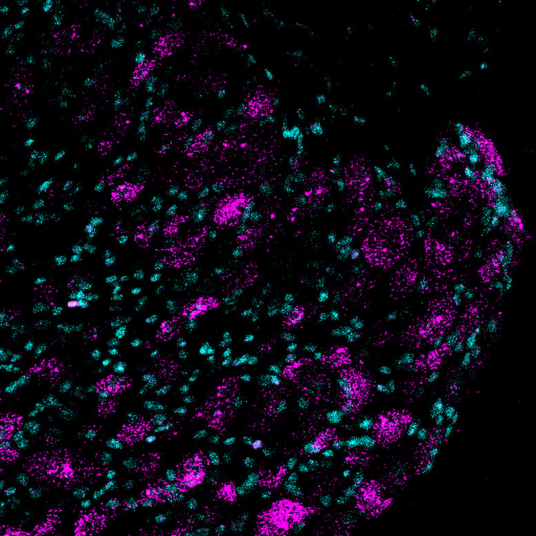 Image of Piezo2 Gene Expression