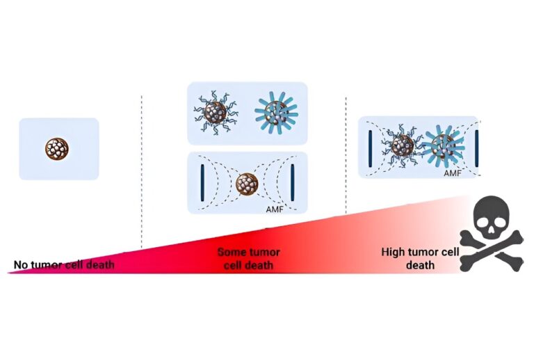 A combination of multicore magnetic nanoparticles and chemotherapy drugs achieves greater efficacy against cancer cells