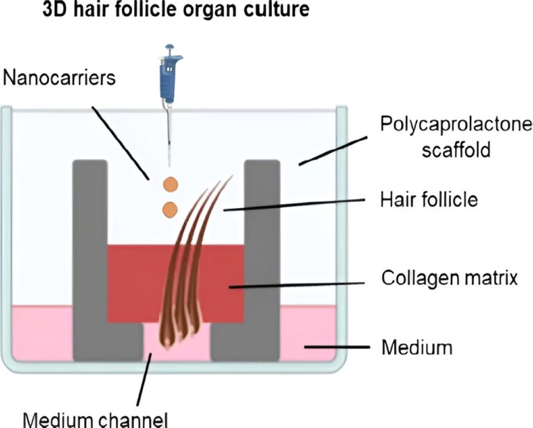 Researchers develop 3D printed model for targeted antibiotic therapy against follicular infections