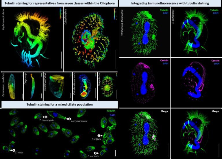 Ciliated eukaryotes study offers simple, versatile method for tubulin staining