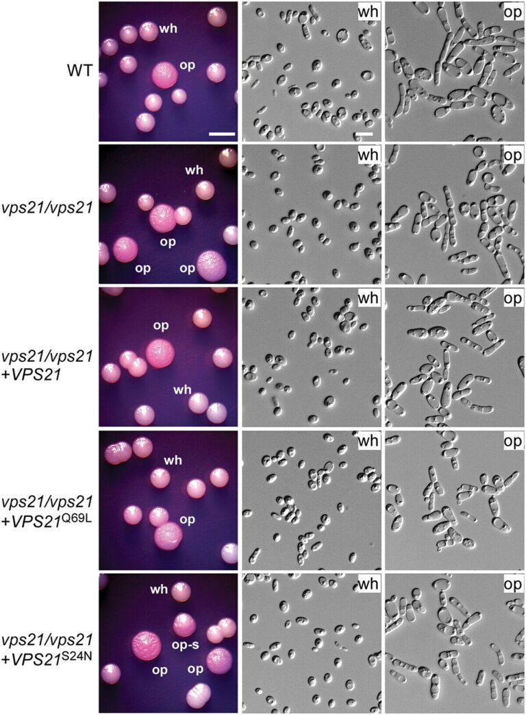 Vps21 signaling pathway regulates white-opaque switching and mating in Candida albicans