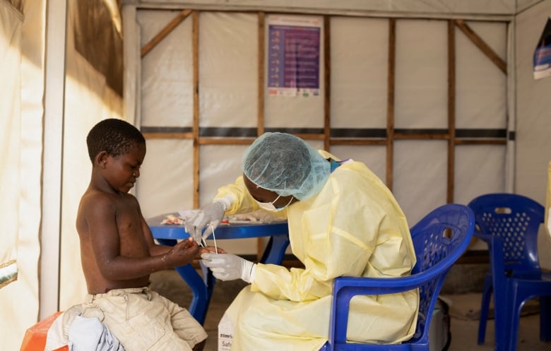 A nurse takes a sample from a child declared a suspected case of mpox at a treatment centre in the Democratic Republic of Congo in July 2024. 