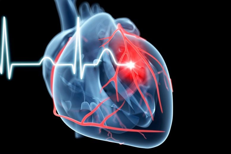 Cardiology Heart Attack Illustration