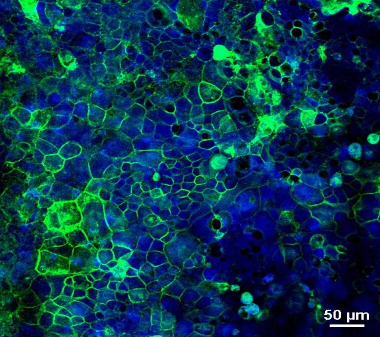 Opened Celiac Research Organoid