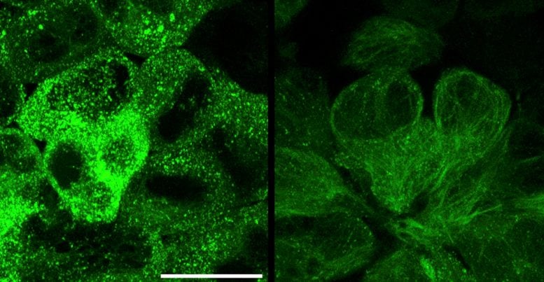 Tau Aggregates Before and After