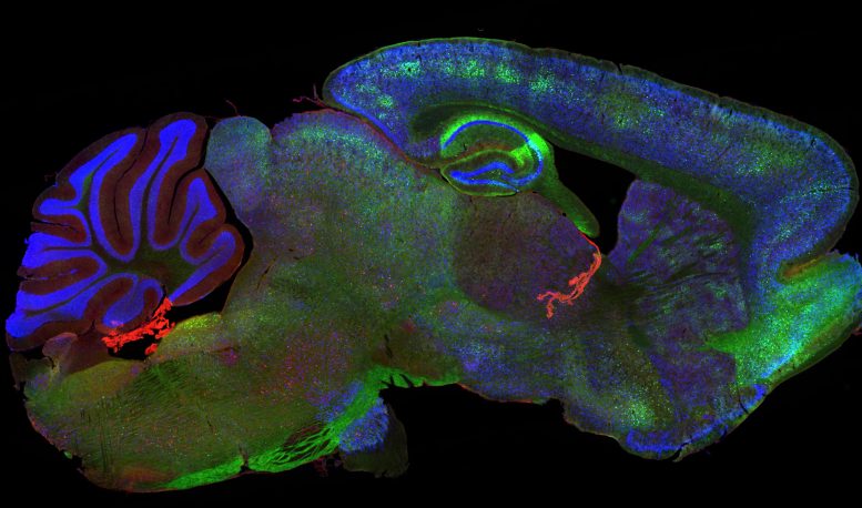 Mouse Brain Treated With RING-Bait