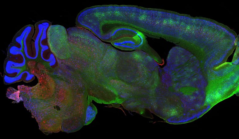 Mouse Brain Treated With Tau Therapy Placebo