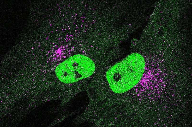 Double-edged STING: Pitt study identifies new pathway involved in aging