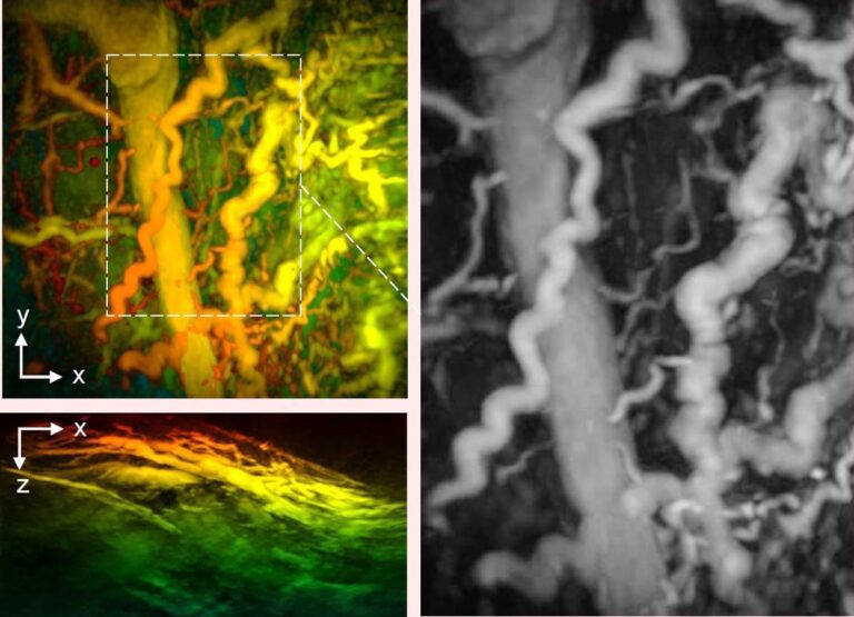 New Hand-Held Scanner Revolutionizes Disease Detection