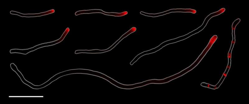 Open Wide: Human Mouth Bacteria Reproduce through Rare Form of Cell Division